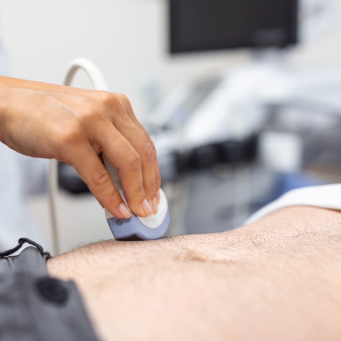 Ultrasound diagnosis of the stomach on the abdominal cavity of a man in the clinic, close-up view. The doctor runs an ultrasound sensor over the patient's male abdomen. Diagnostics of internal organs.